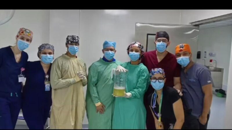 Hospital de la Mujer realiza primer procedimiento de Amniodrenaje
